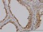 GGT1 Antibody (monoclonal) (M01)